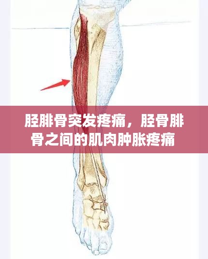 胫腓骨突发疼痛，胫骨腓骨之间的肌肉肿胀疼痛 